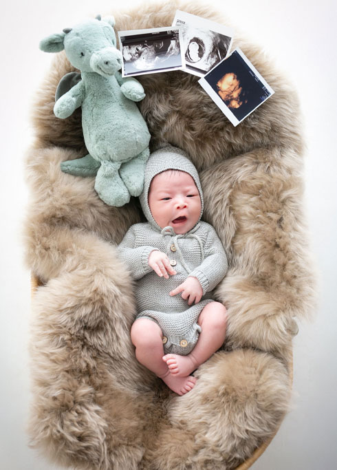 ニューボーン：エコー写真とドラゴンのぬいぐるみと並びニットのロンパースを着てあくびをする赤ちゃん